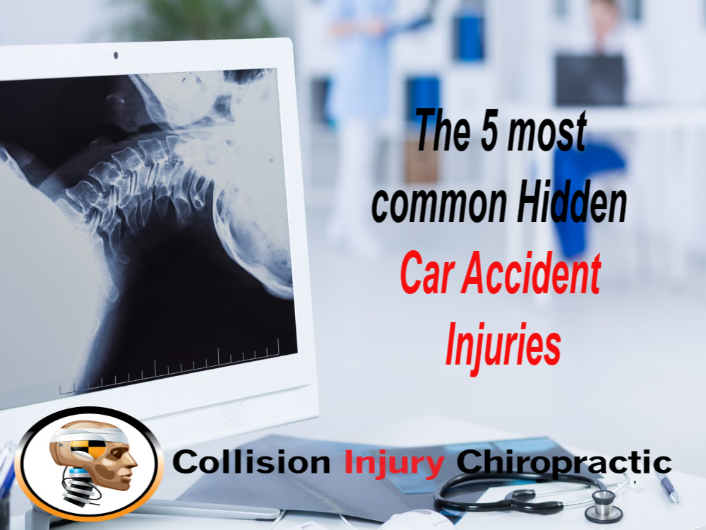 The 5 Most Common Hidden Car Accident Injuries