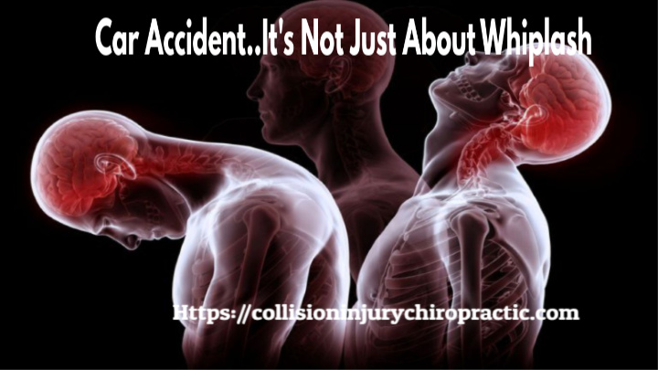Car Accident It’s Not Just About Whiplash