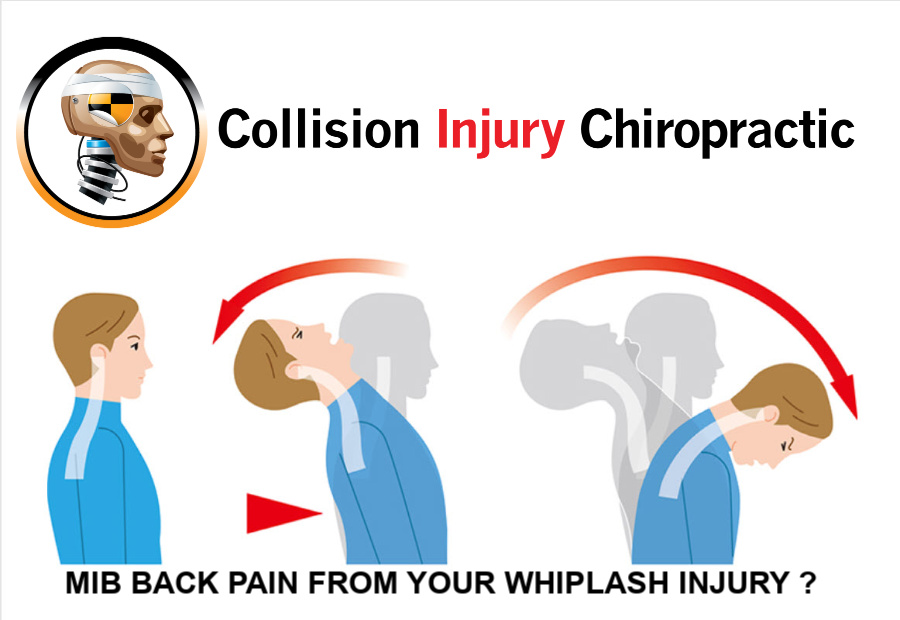 Mid Back Pain From A Whiplash Injury