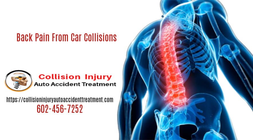 Graphic Showing Back Pain From Car Accident